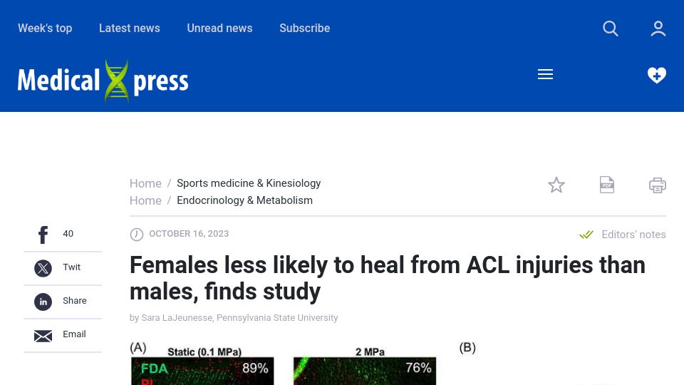 Screenshot of medicalxpress.com: Females less likely to heal from ACL injuries than males, finds study