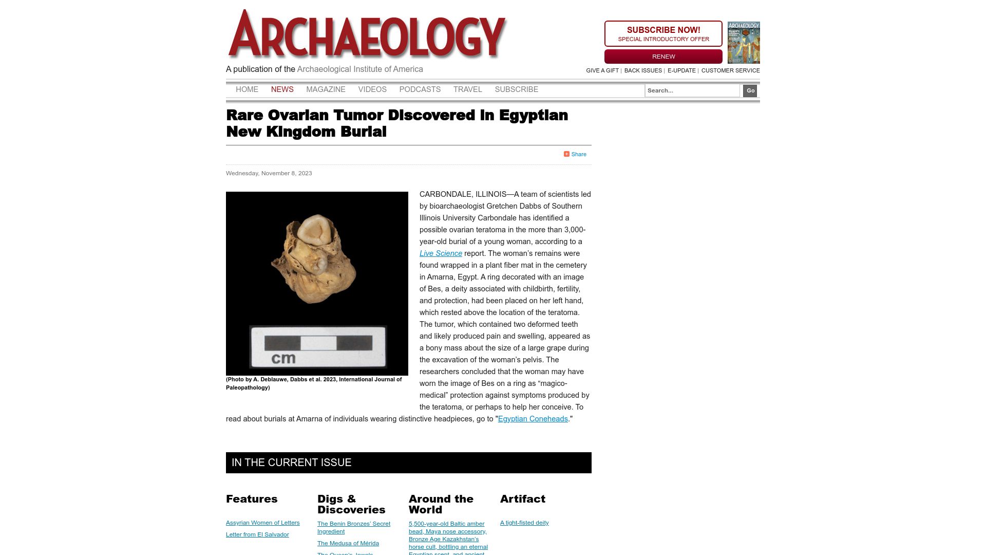 Screenshot of archaeology.org: Rare Ovarian Tumor Discovered in Egyptian New Kingdom Burial