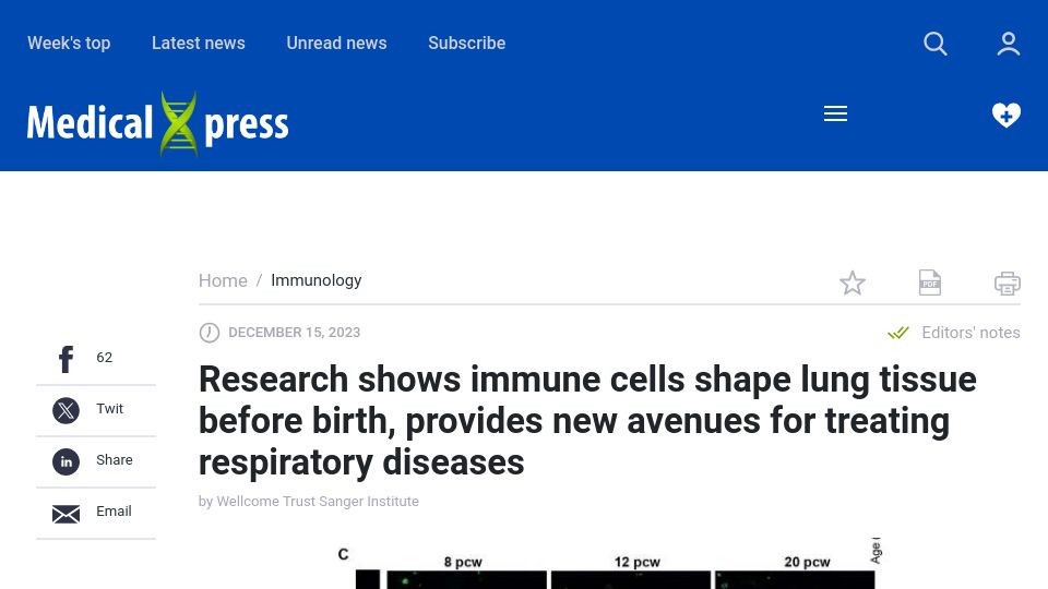 Screenshot of medicalxpress.com: Research shows immune cells shape lung tissue before birth