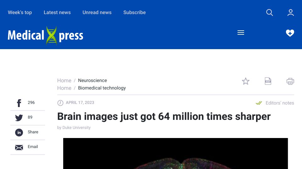 Screenshot of medicalxpress.com: Brain images just got 64 million times sharper