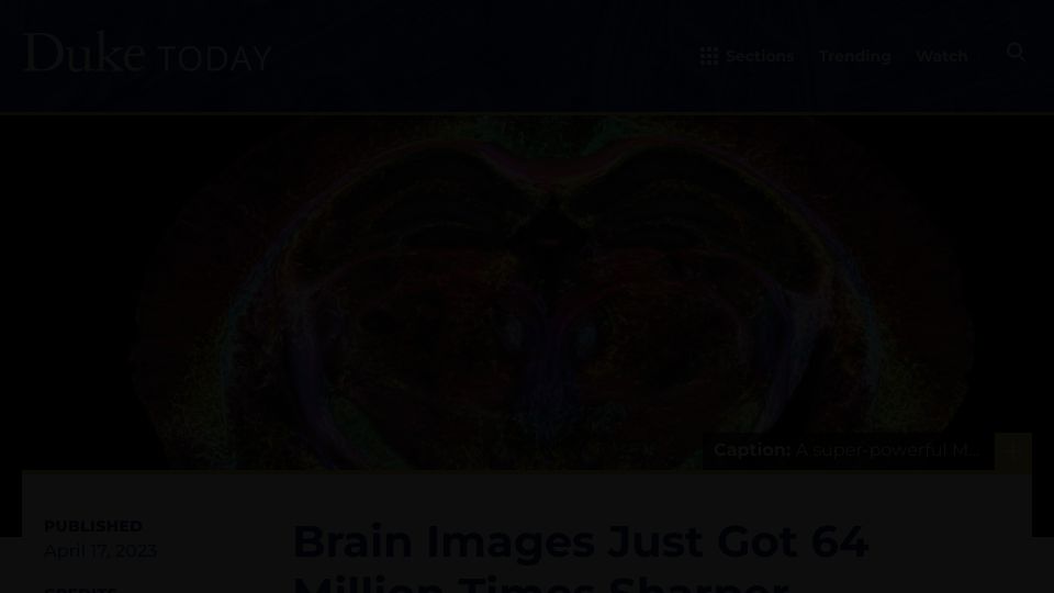 Screenshot of today.duke.edu: MRI brain images become 64M times sharper