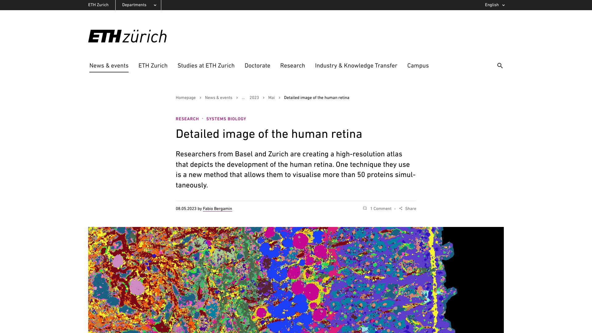 Screenshot of ethz.ch: Detailed Image of the Human Retina