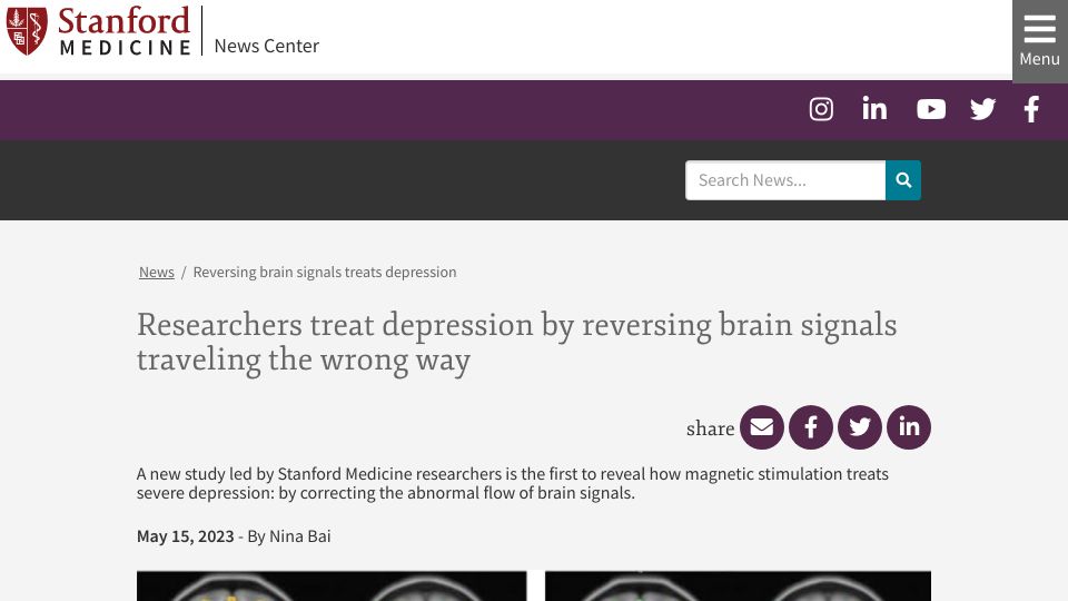 Screenshot of med.stanford.edu: Researchers treat depression by reversing brain signals traveling the wrong way