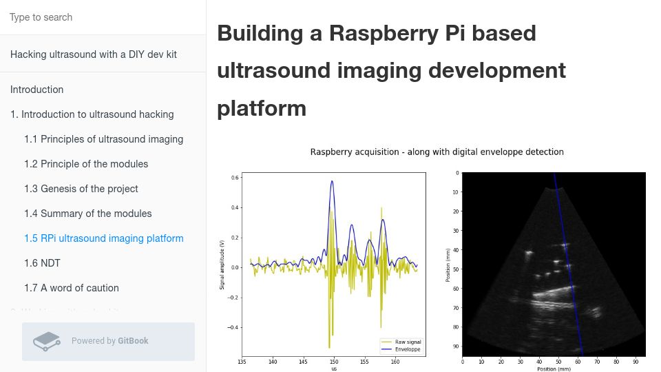 Screenshot of kelu124.gitbooks.io: Building a Raspberry Pi based ultrasound imaging development platform
