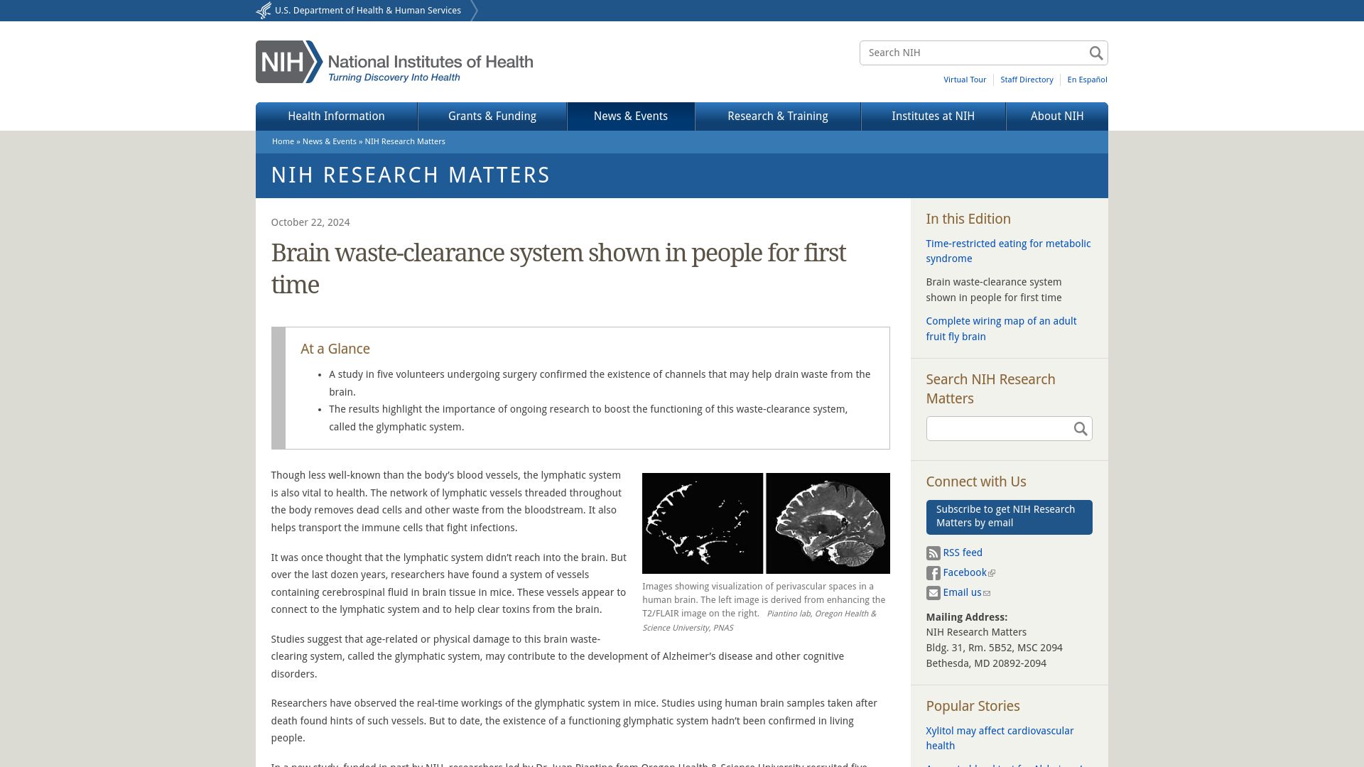 Screenshot of nih.gov: The brain's waste clearing lymphatic system shown in people for first time