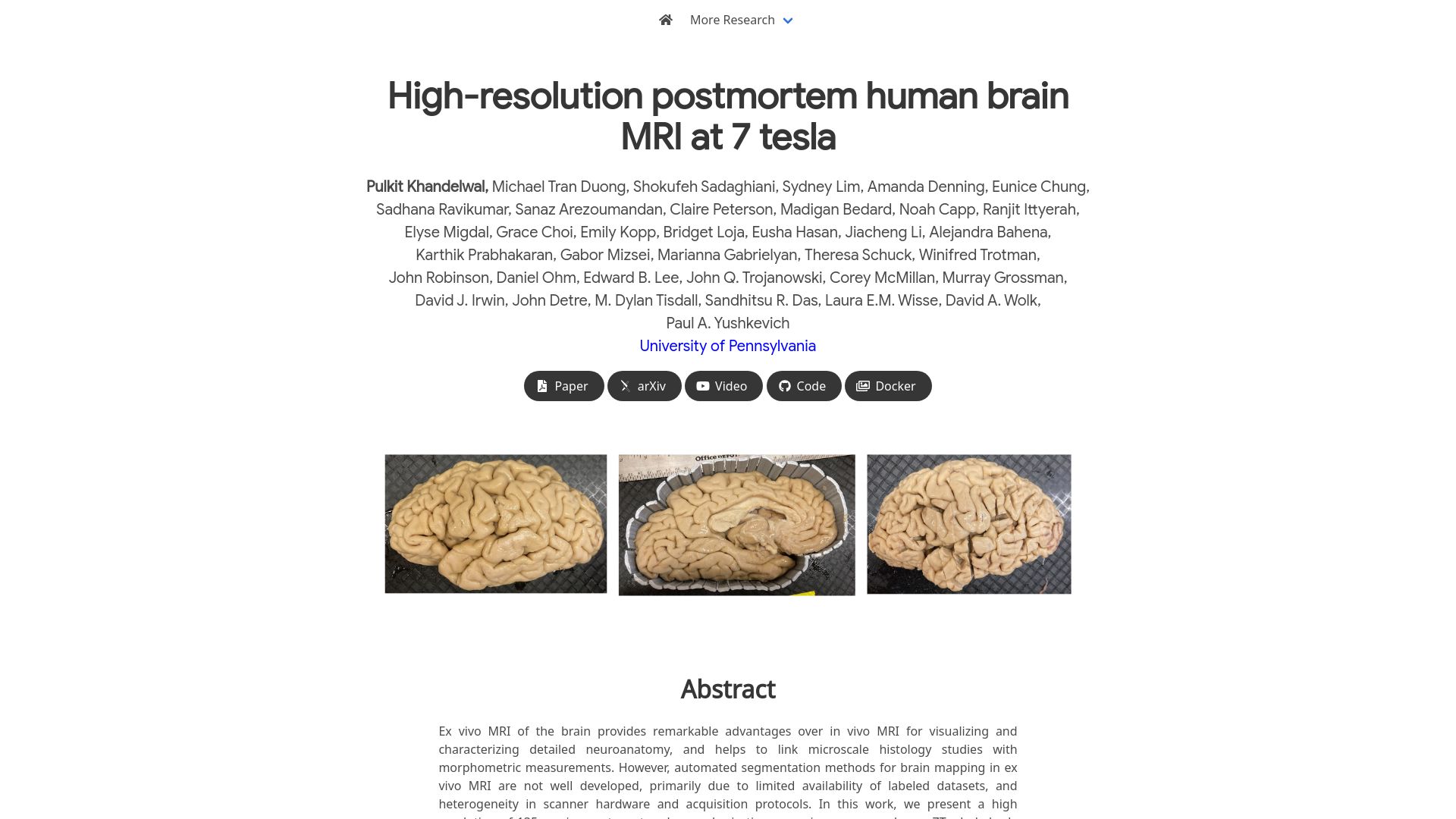 Screenshot of pulkit-khandelwal.github.io: High-resolution postmortem human brain MRI at 7 tesla