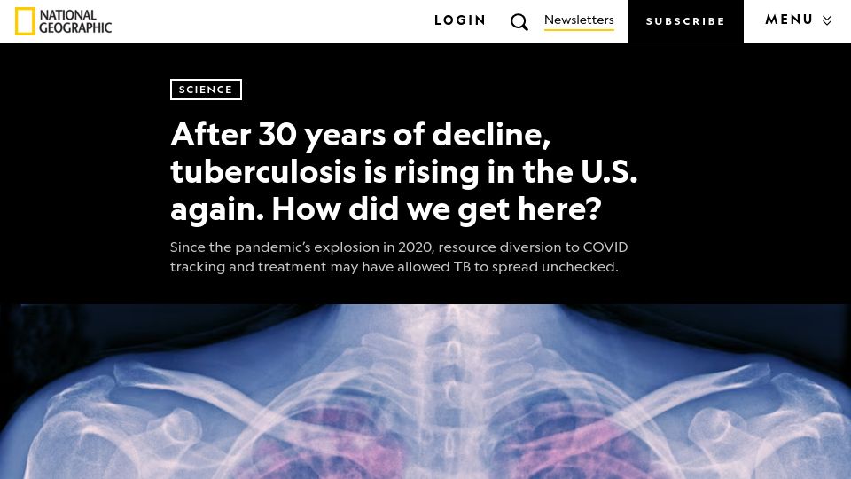Screenshot of nationalgeographic.com: Tuberculosis is rising in the U.S. again. How did we get here?