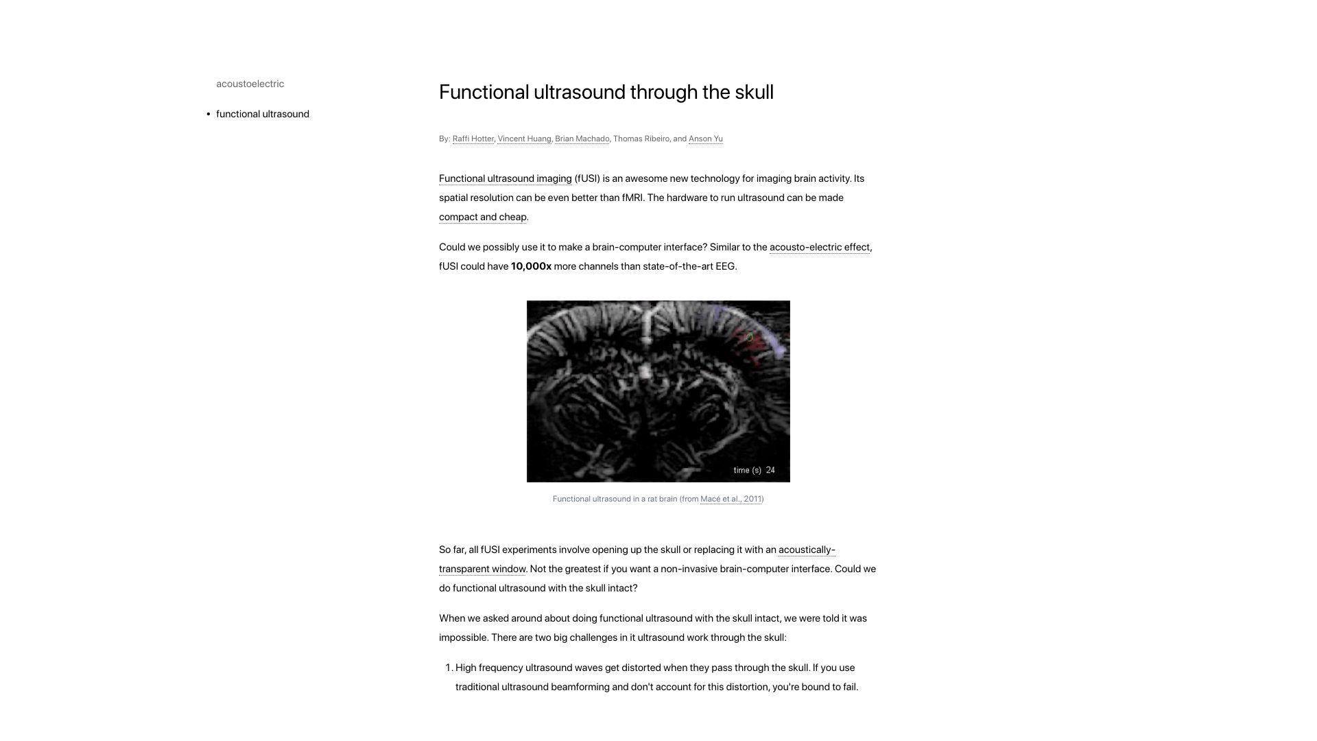 Screenshot of brainhack.vercel.app: Functional ultrasound through the skull