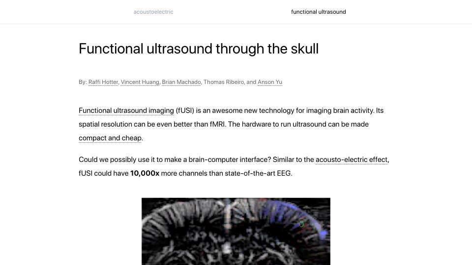 Screenshot of brainhack.vercel.app: Functional ultrasound through the skull