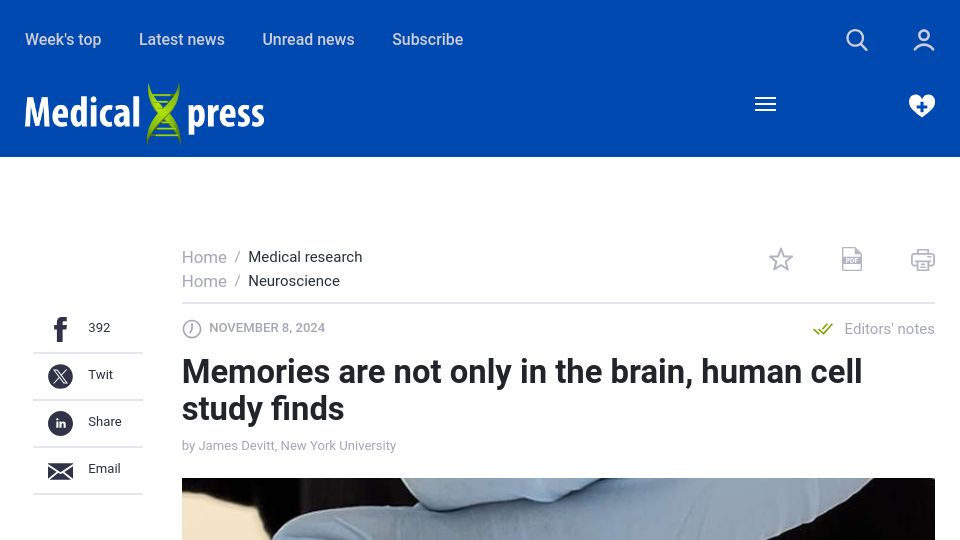 Screenshot of medicalxpress.com: Memories are not only in the brain, human cell study finds