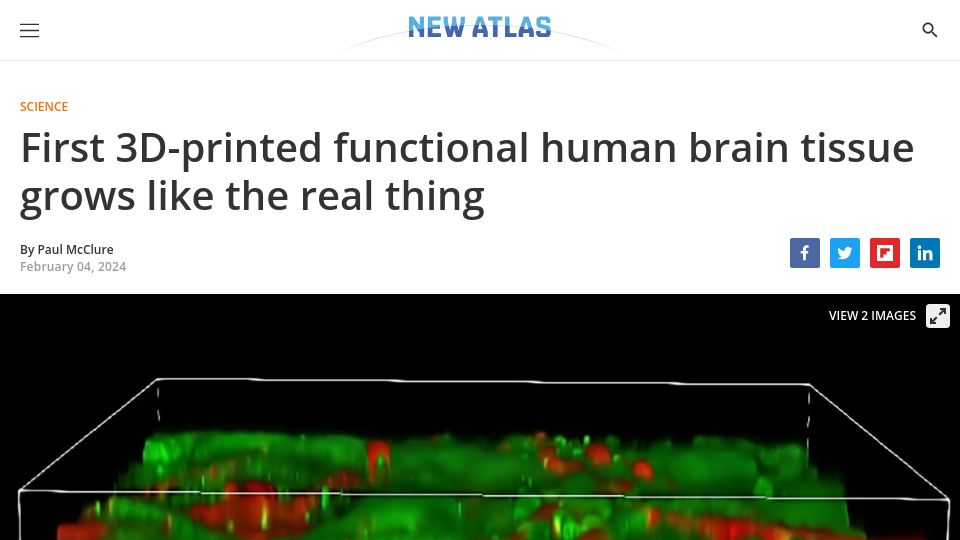 Screenshot of newatlas.com: First 3D-printed functional human brain tissue grows like the real thing
