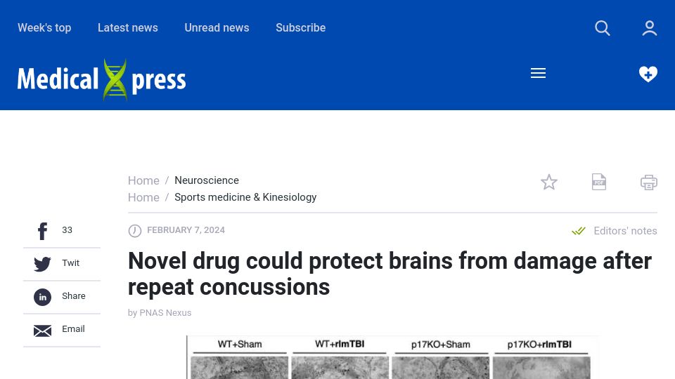 Screenshot of medicalxpress.com: Novel drug could protect brains from damage after repeat concussions