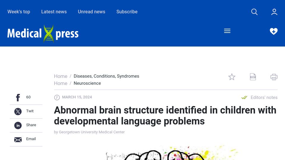 Screenshot of medicalxpress.com: Abnormal brain structure seen in children with developmental language issues