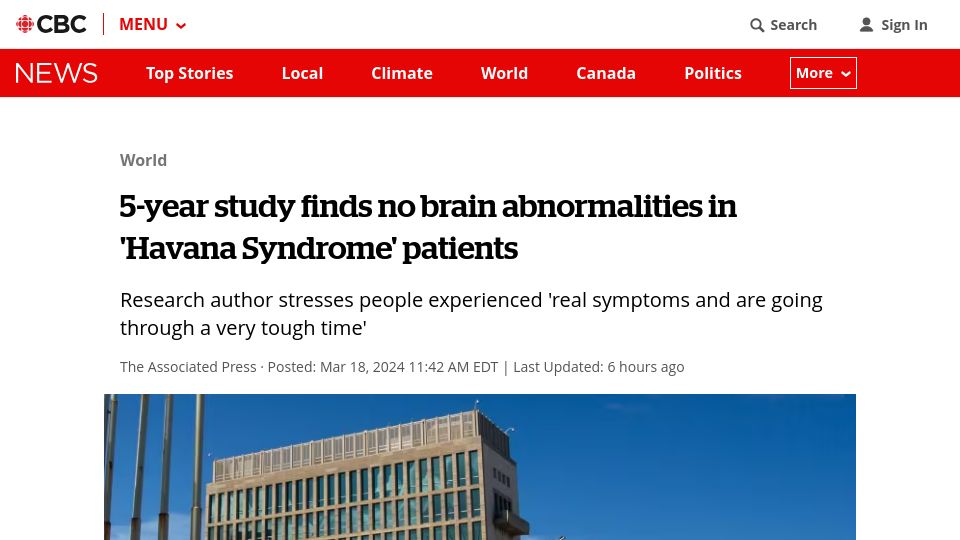Screenshot of cbc.ca: 5-year study finds no brain abnormalities in 'Havana Syndrome' patients