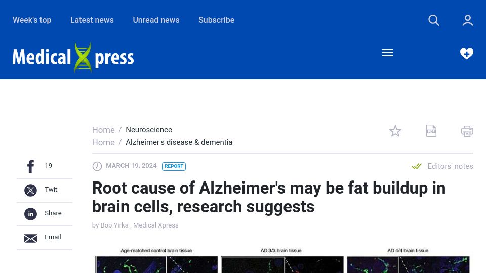 Screenshot of medicalxpress.com: Root cause of Alzheimer's may be fat buildup in brain cells, research suggests