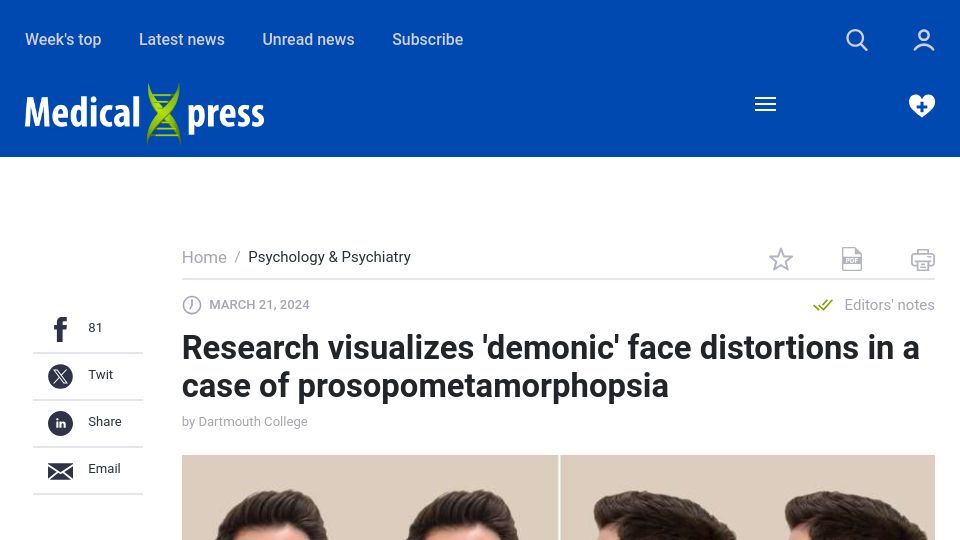 Screenshot of medicalxpress.com: Visualization 'demonic' face distortions in a case of prosopometamorphopsia