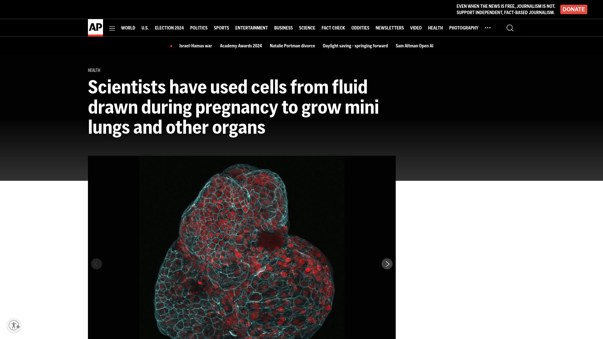 Screenshot of apnews.com: Cells from Pregnancy Fluid Used to Grow Mini Lungs, Organs