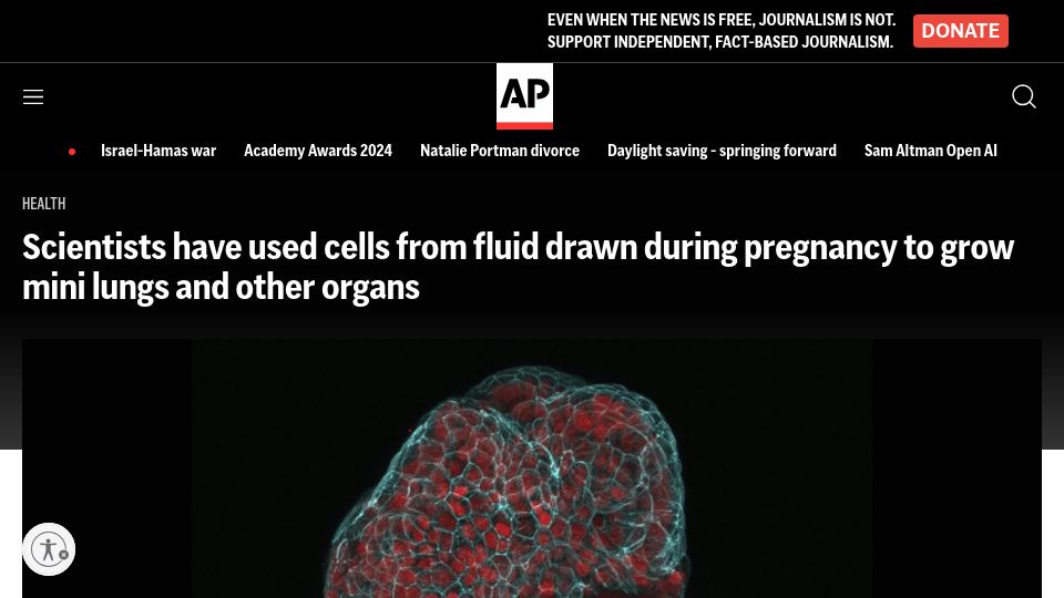Screenshot of apnews.com: Cells from Pregnancy Fluid Used to Grow Mini Lungs, Organs