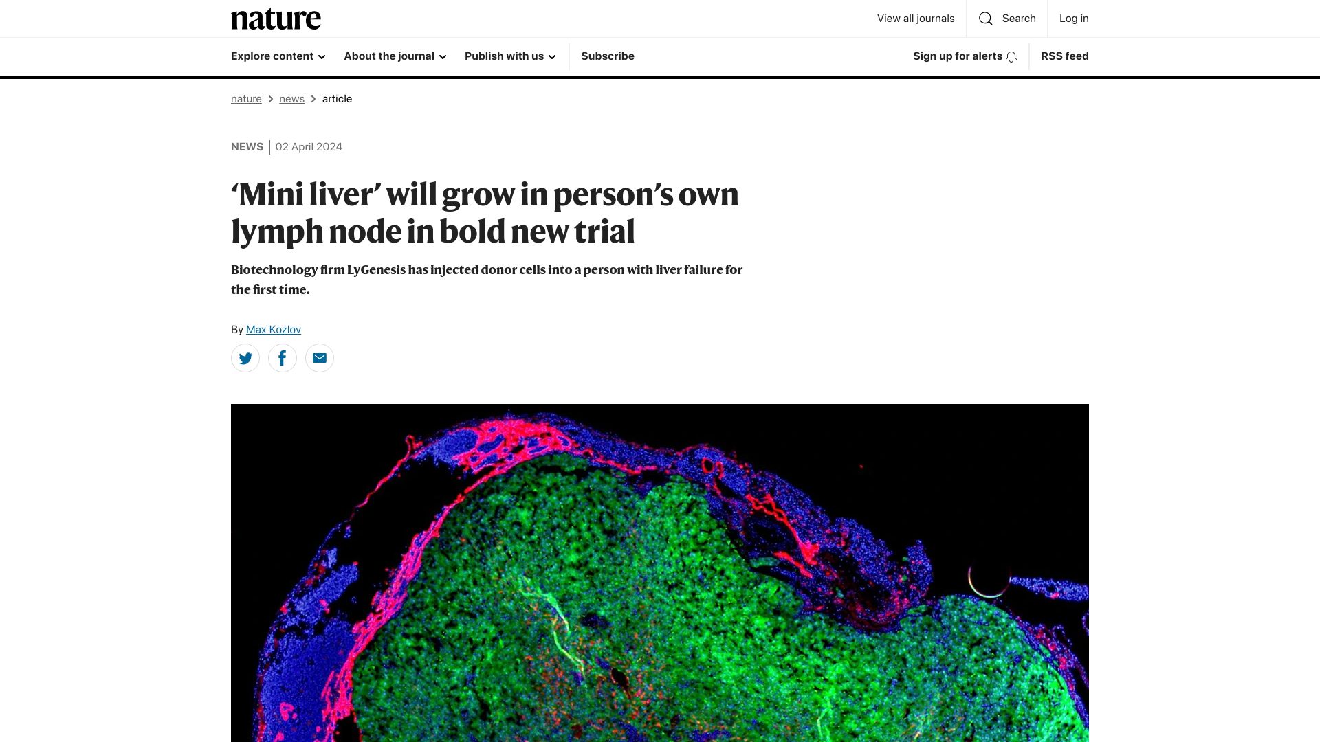 Screenshot of nature.com: 'Mini liver' will grow in person's own lymph node in bold new trial