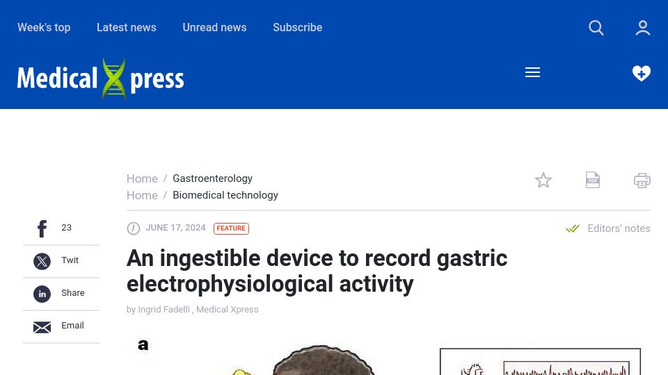 Screenshot of medicalxpress.com: An ingestible device to record gastric electrophysiological activity