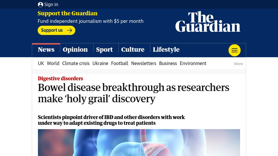 Screenshot of theguardian.com: Researchers identify major driver of inflammatory bowel and related diseases