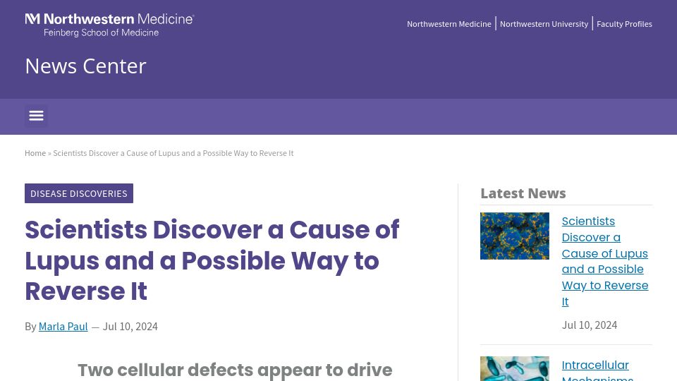 Screenshot of news.feinberg.northwestern.edu: Scientists discover a cause of lupus, possible way to reverse it