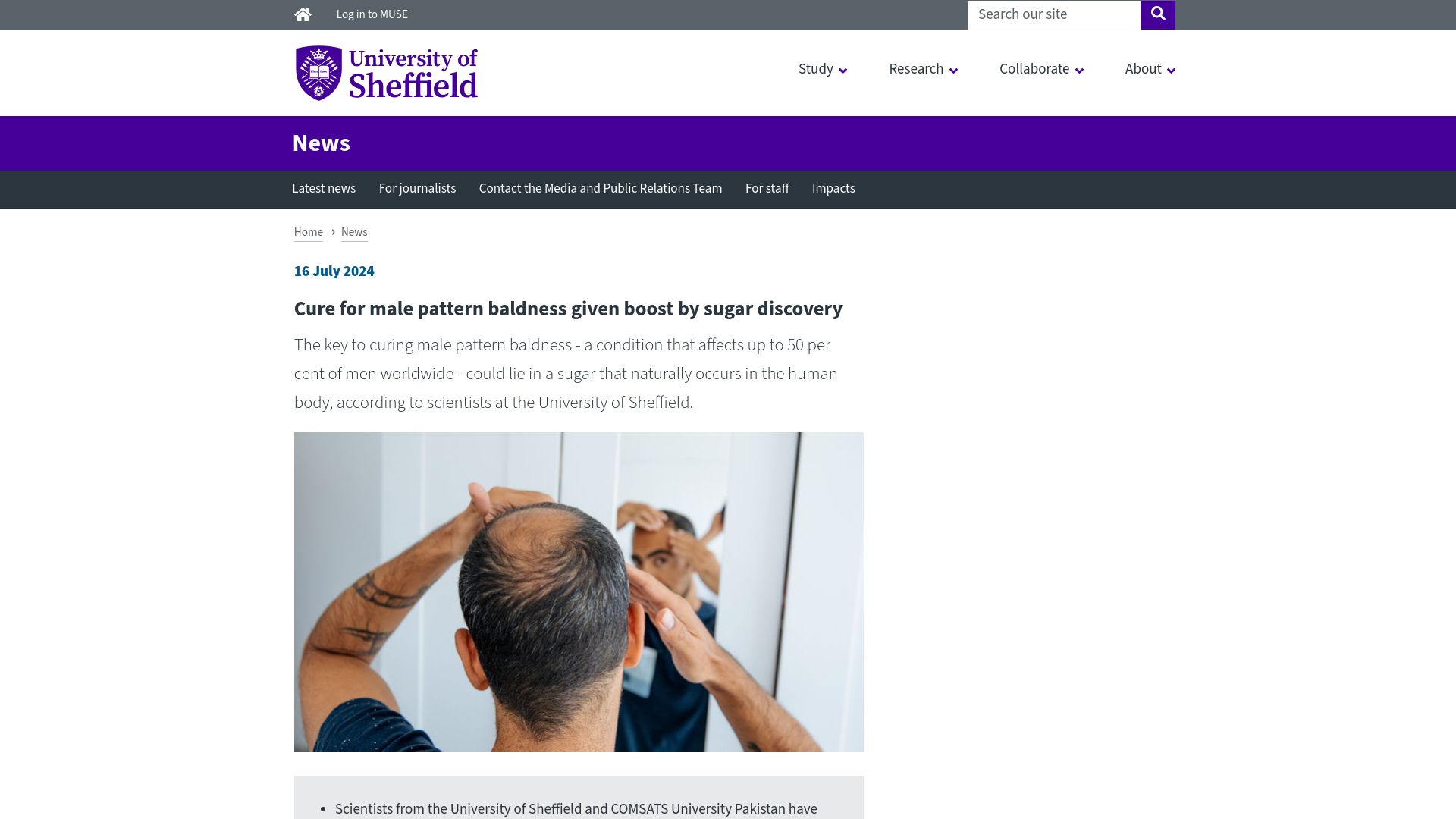 Screenshot of sheffield.ac.uk: Cure for male pattern baldness given boost by sugar discovery