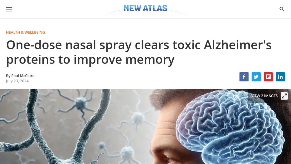 Screenshot of newatlas.com: One-dose nasal spray clears toxic Alzheimer's proteins to improve memory