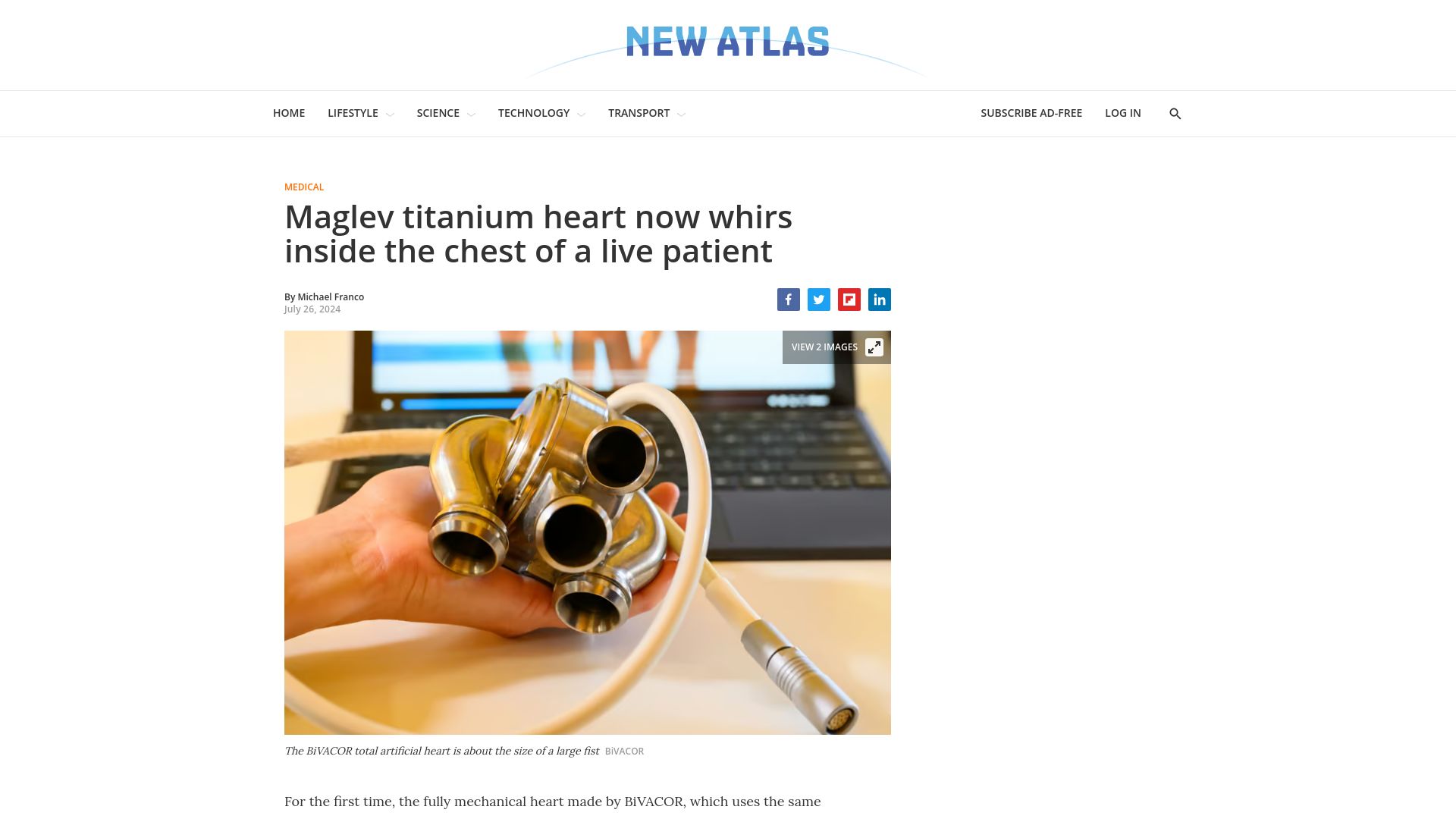 Screenshot of newatlas.com: Maglev titanium heart inside the chest of a live patient
