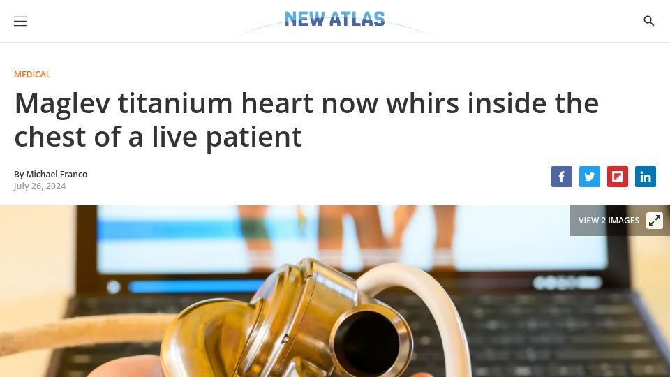 Screenshot of newatlas.com: Maglev titanium heart inside the chest of a live patient