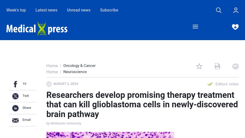 Screenshot of medicalxpress.com: Researchers develop treatment that can kill glioblastoma cells in brain pathway