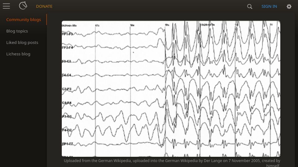 Screenshot of lichess.org: A Case Study of Reflex Epilepsy Induced by Playing Chess