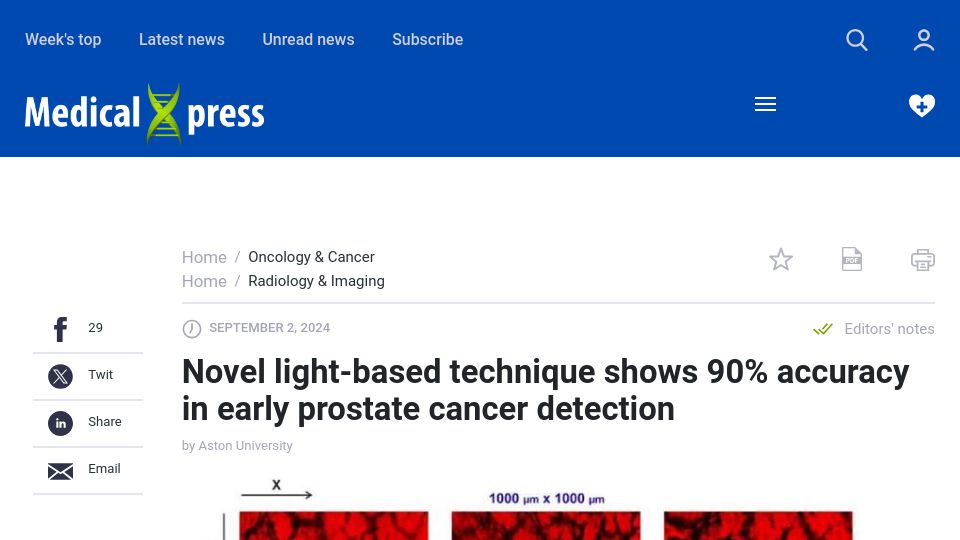 Screenshot of medicalxpress.com: Light-based technique shows 90% accuracy in early prostate cancer detection