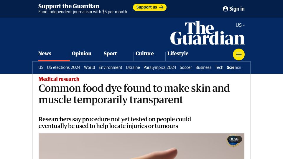 Screenshot of theguardian.com: Common food dye found to make skin and muscle temporarily transparent