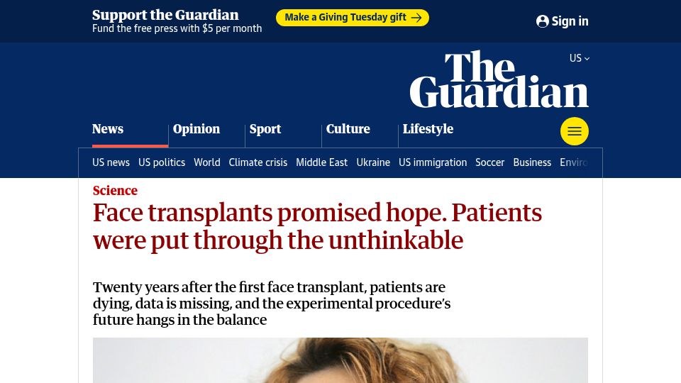 Screenshot of theguardian.com: Face transplants promised hope. Patients were put through the unthinkable