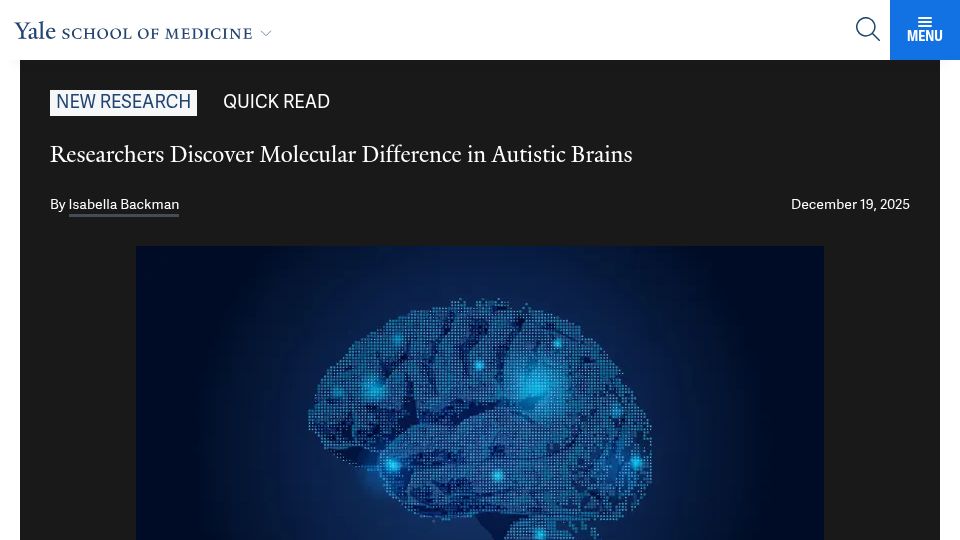 Screenshot of medicine.yale.edu: Researchers discover molecular difference in autistic brains