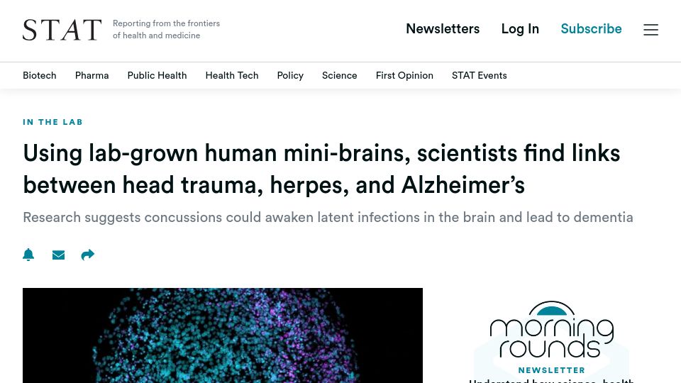 Screenshot of statnews.com: Scientists find links between Alzheimer's, herpes, and head trauma