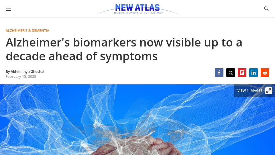 Screenshot of newatlas.com: Alzheimer's biomarkers now visible up to a decade ahead of symptoms