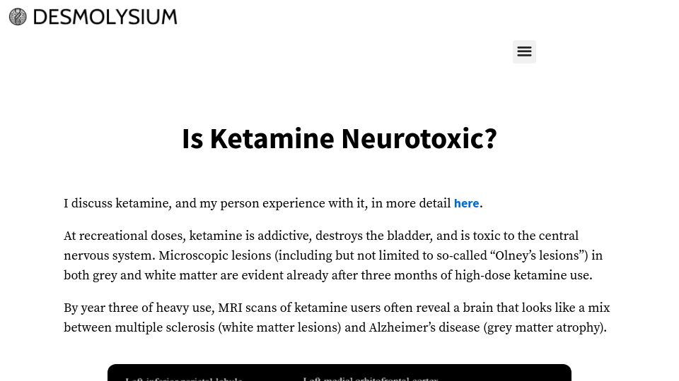 Screenshot of desmolysium.com: Is Ketamine Neurotoxic?