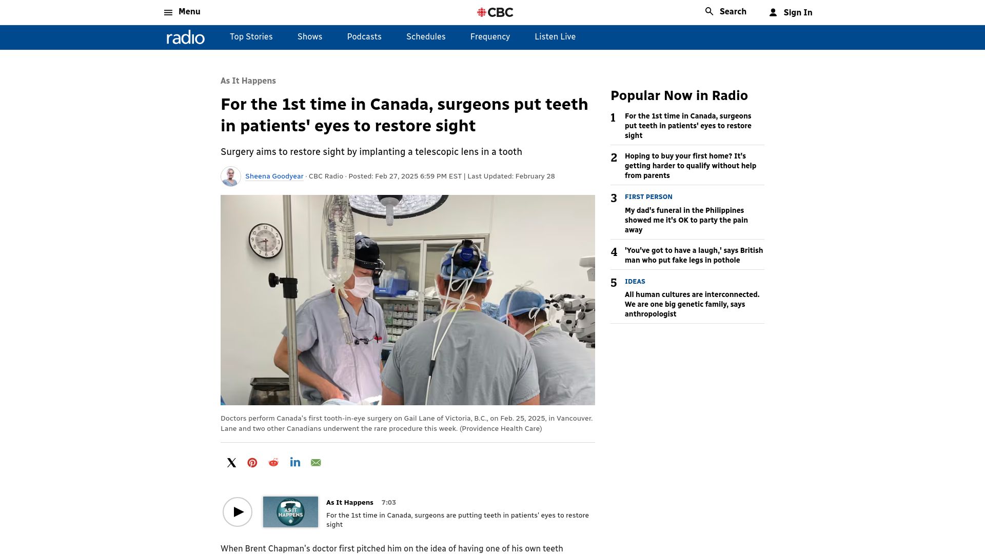 Screenshot of cbc.ca: Surgery implants tooth material in eye as scaffolding for lens