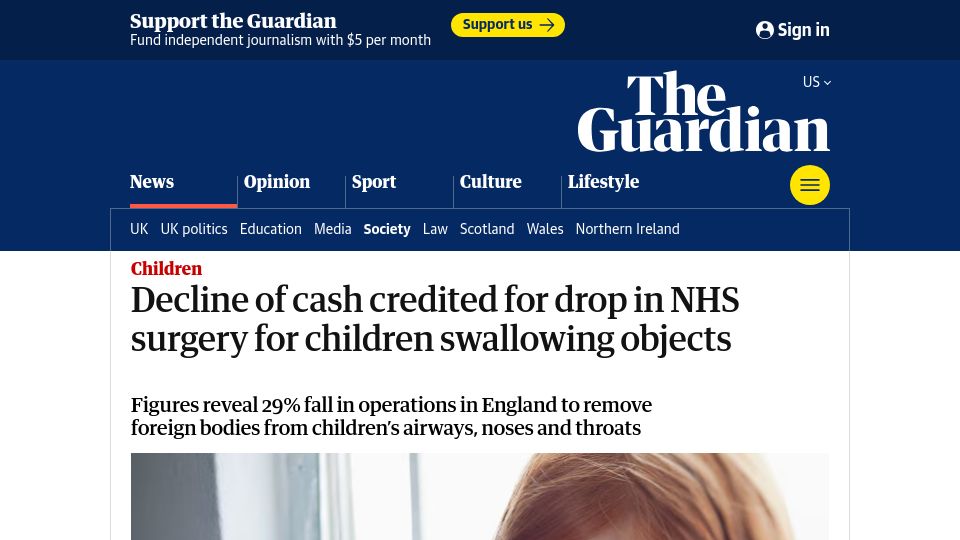 Screenshot of theguardian.com: Decline of cash credited for drop in surgery for children swallowing objects