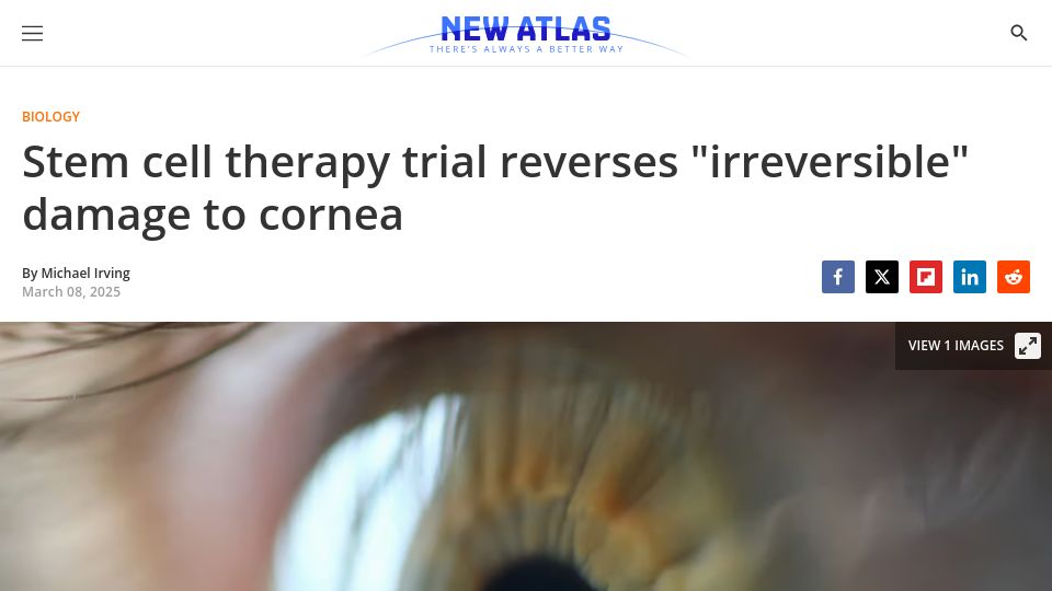 Screenshot of newatlas.com: Stem cell therapy trial reverses "irreversible" damage to cornea