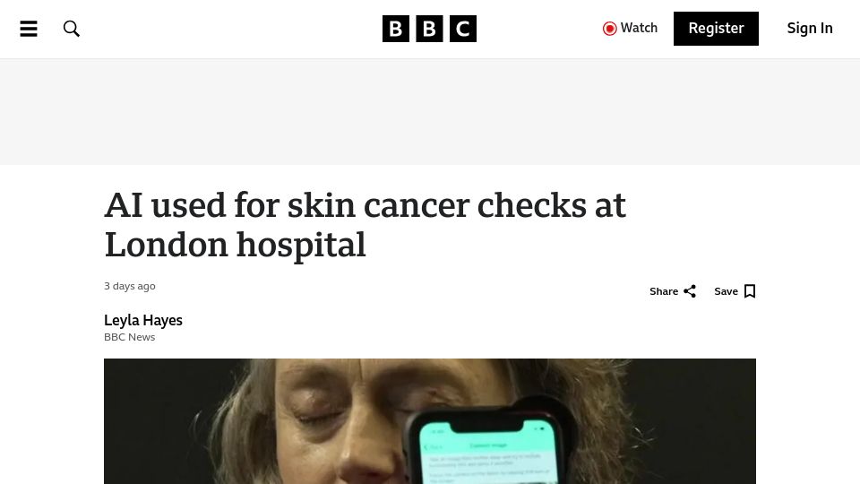 Screenshot of bbc.com: AI used for skin cancer checks at London hospital