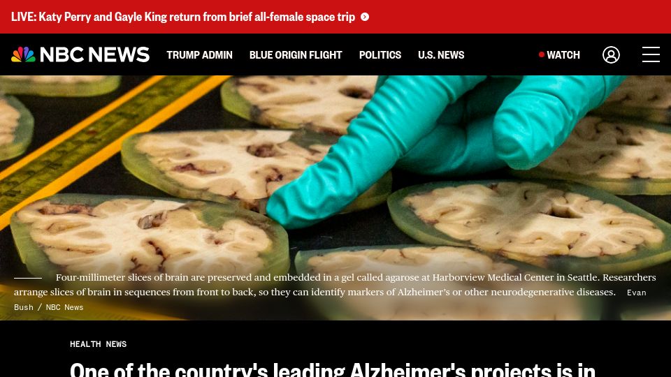 Screenshot of nbcnews.com: One of the country's leading Alzheimer's projects is in jeopardy