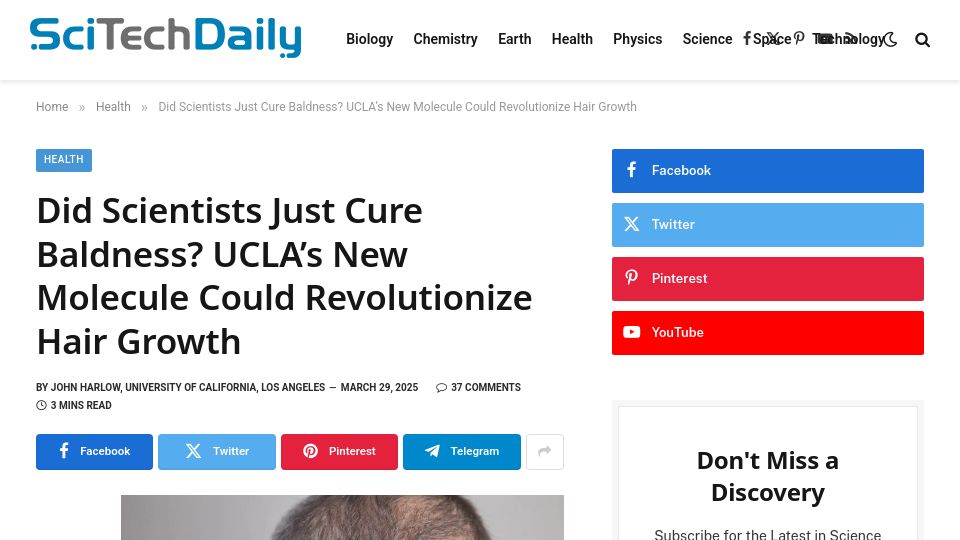 Screenshot of scitechdaily.com: Baldness? UCLA's New Molecule Could Revolutionize Hair Growth