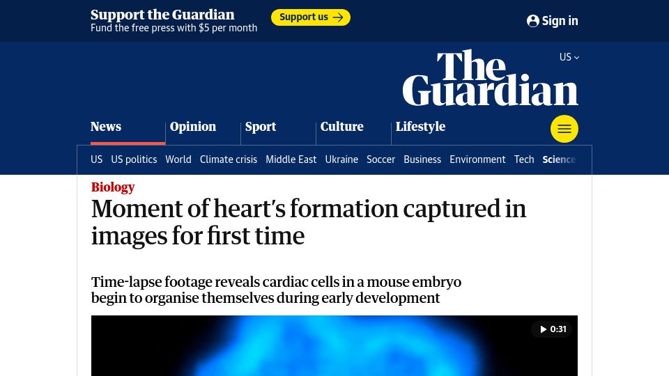 Screenshot of theguardian.com: Moment of heart's formation captured in images for first time