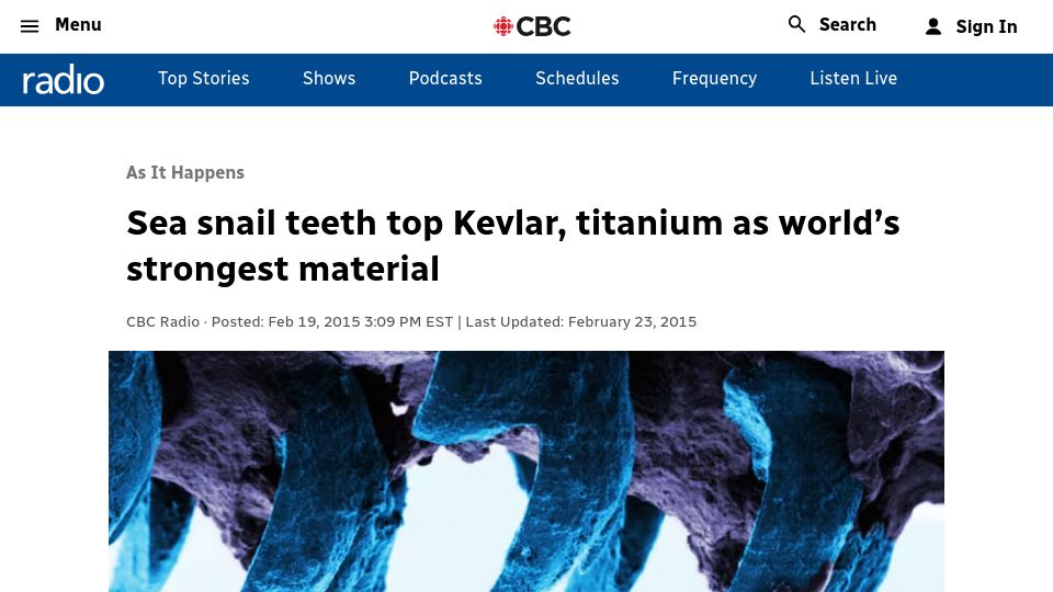 Screenshot of cbc.ca: Sea snail teeth top Kevlar, titanium as strongest material (2015)