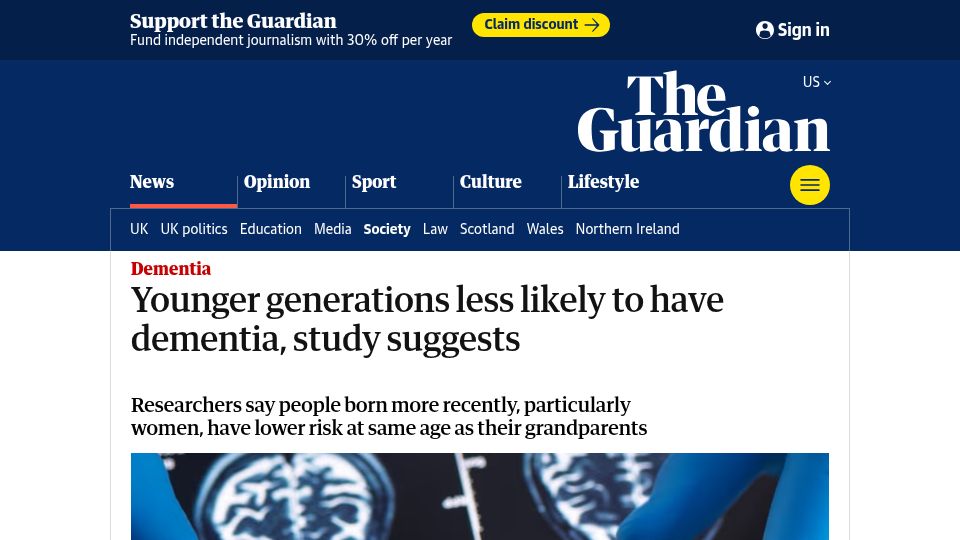 Screenshot of theguardian.com: Younger generations less likely to have dementia, study suggests