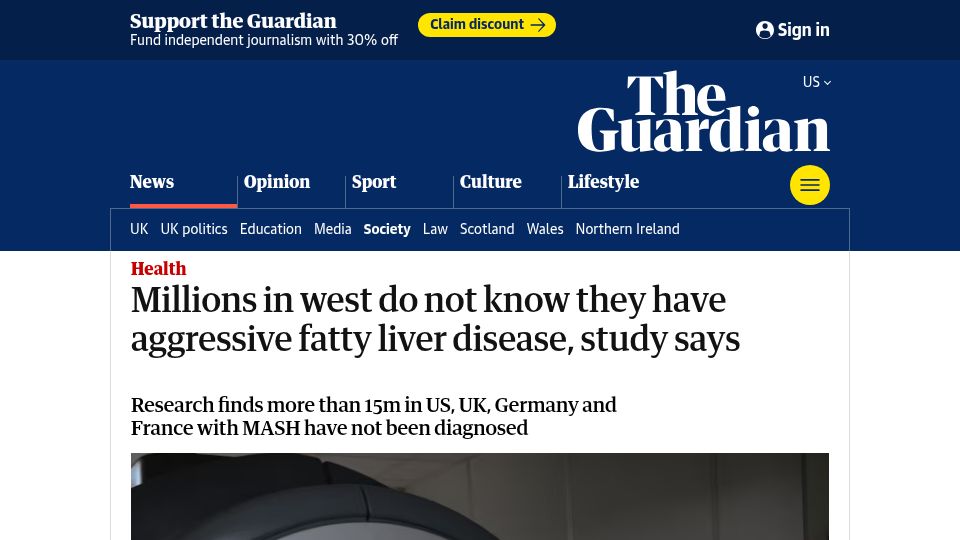 Screenshot of theguardian.com: Millions in west don't know they have aggressive fatty liver disease, study says