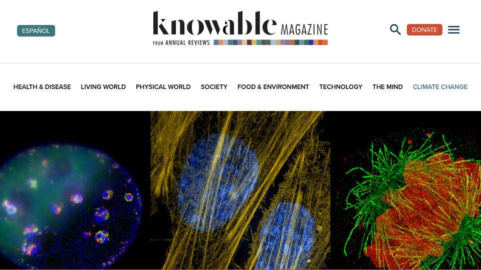 Screenshot of knowablemagazine.org: Super-resolution microscopes reveal new details of cells and disease